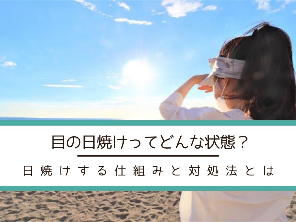 【目が日焼けをしやすい人の特徴】仕組みやリスク、対処法を解説!