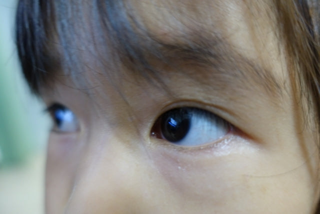 視力が低下している子どもが増えている原因は？｜矯正・予防の方法とは
