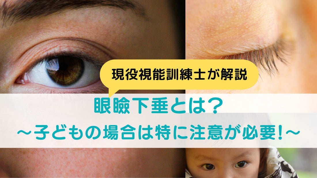 眼瞼下垂とは？原因は何？子どもの場合は特に注意が必要！
